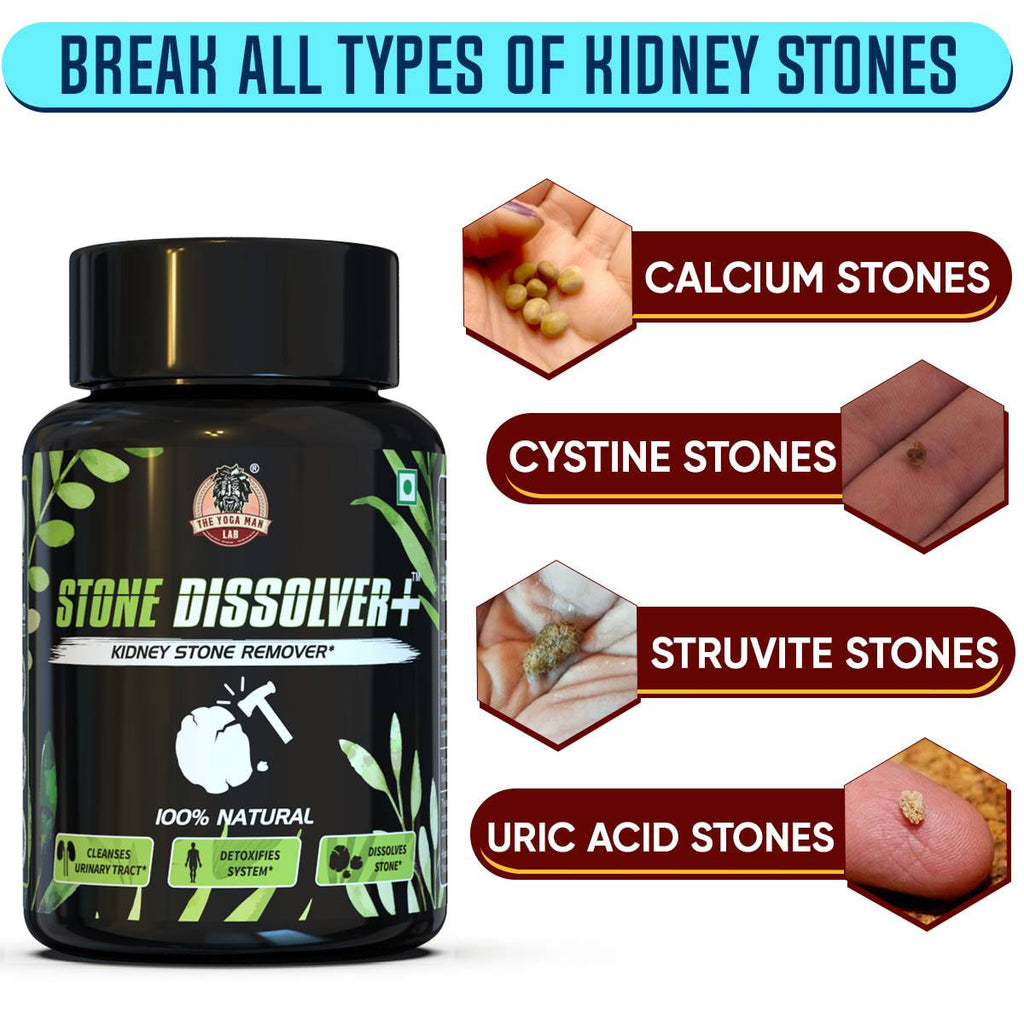 STONE DISSOLVER+ - Stone Remover Ayurvedic Supplement | 100% Natural & Plant Based
