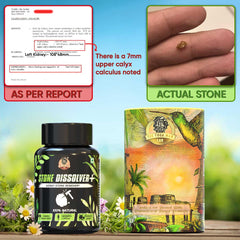 STONE DISSOLVER+ - Stone Remover Ayurvedic Supplement | 100% Natural & Plant Based