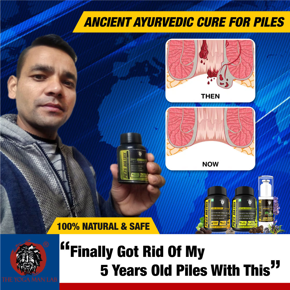 PILES MATRIX - Vein Restore + Rectum Restore Ayurvedic Supplements + Herbal Remedies Diet Booklet | Relives Pain & Shrinks Mass | 100% Natural Health Care > Gut Health > Piles > Medicine > Ayurvedic Piles Treatment The Yoga Man Lab   