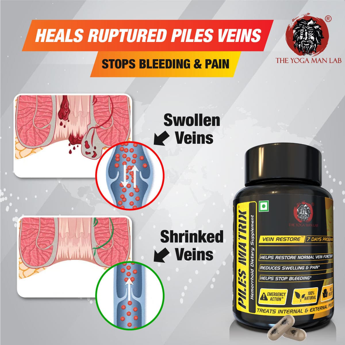 Piles Matrix - वेन रिस्टोर + रेक्टम रिस्टोर+ डाइट बुकलेट Health Care > Gut Health > Piles > Medicine, Gel > Ayurvedic Piles Treatment The Yoga Man Lab   