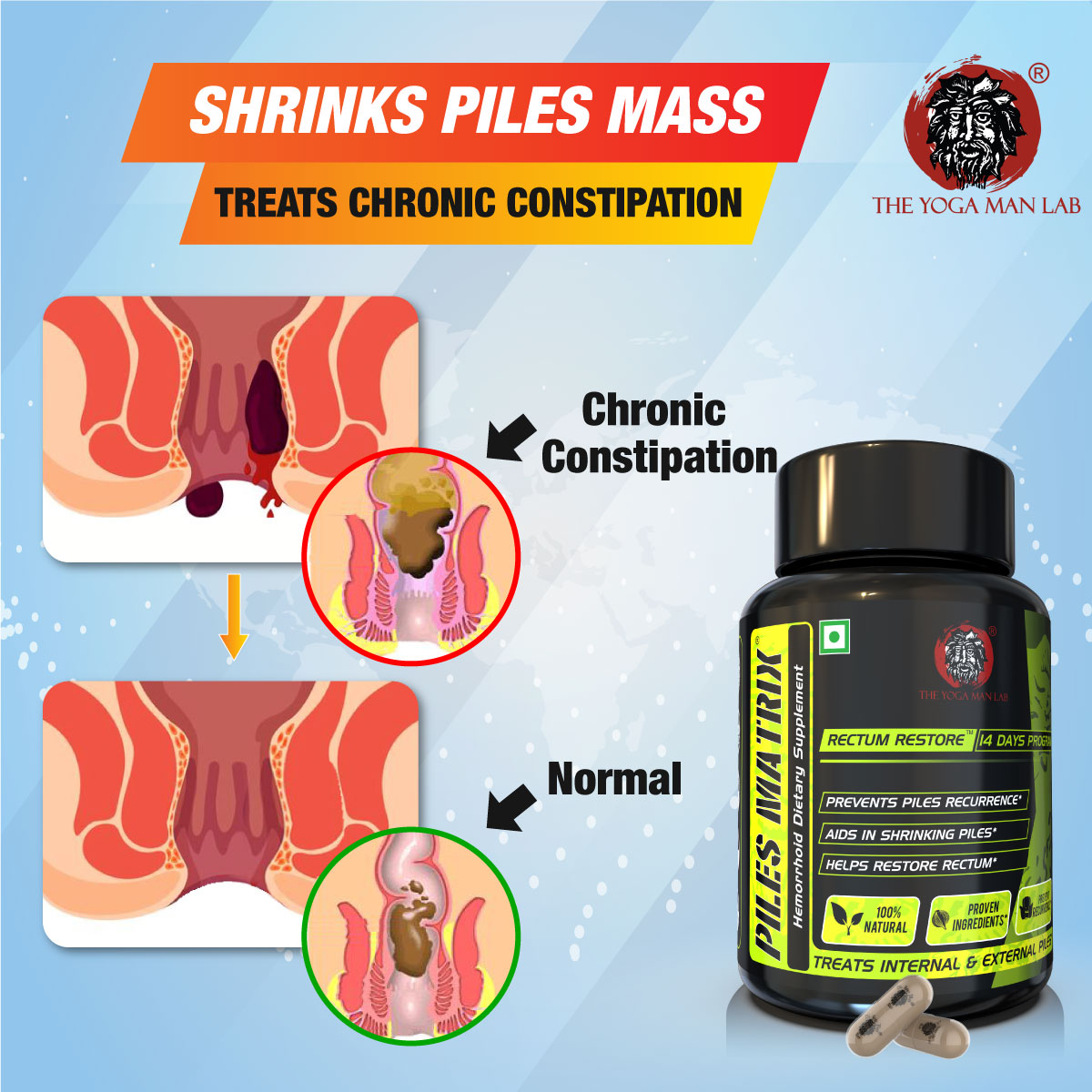 Piles Matrix - वेन रिस्टोर + रेक्टम रिस्टोर+ डाइट बुकलेट Health Care > Gut Health > Piles > Medicine, Gel > Ayurvedic Piles Treatment The Yoga Man Lab   