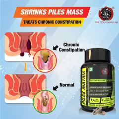 PILES MATRIX - RECTUM RESTORE Ayurvedic Supplement | Shrink Piles Lumps & Mass and Treats Constipation | 100% Natural Health Care > Gut Health > Piles > Medicine > Ayurvedic Piles Treatment The Yoga Man Lab   