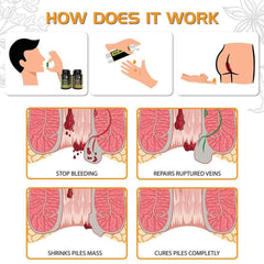 Piles Matrix - वेन रिस्टोर + रेक्टम रिस्टोर+ डाइट बुकलेट Health Care > Gut Health > Piles > Medicine, Gel > Ayurvedic Piles Treatment The Yoga Man Lab   